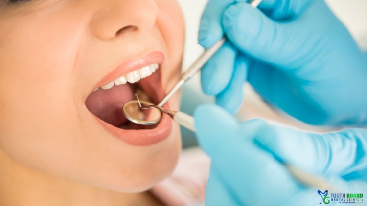 سعر حشو الضرس العادي​ وكل ما تحتاج معرفته قبل العلاج